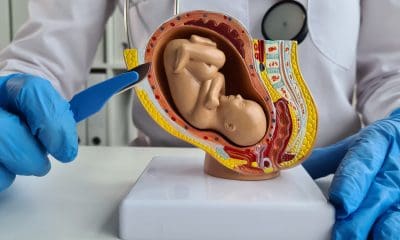 ginekolog pokazuje na czym polega aborcja