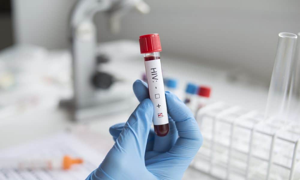 pozytywny test na hiv