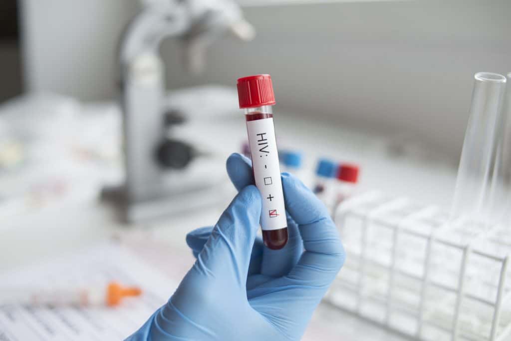 pozytywny test na hiv