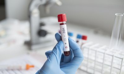 pozytywny test na hiv