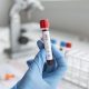 pozytywny test na hiv
