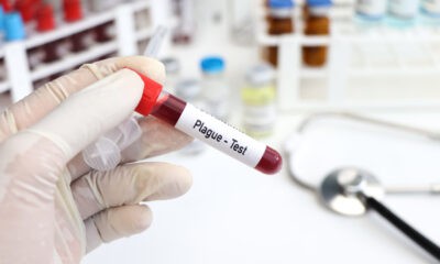 dżuma test krwi