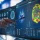 MRI