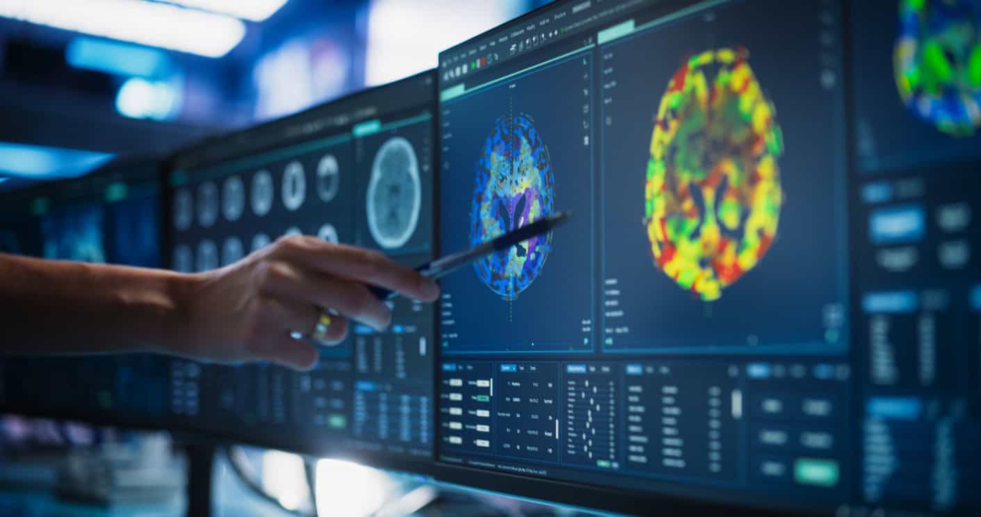 MRI