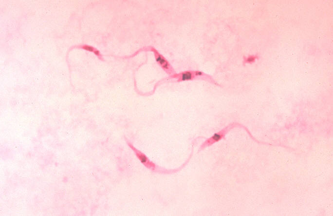 Trypanosoma_cruzi_