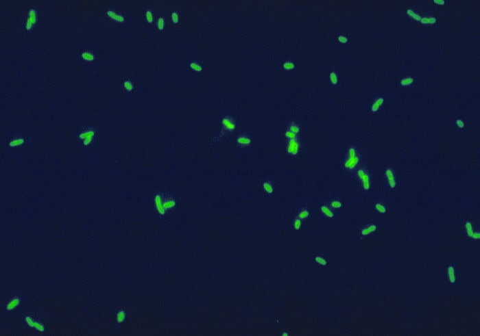 Pałeczki Legionella pneumophila