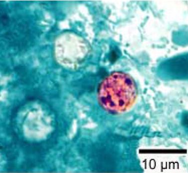 Cyklospora